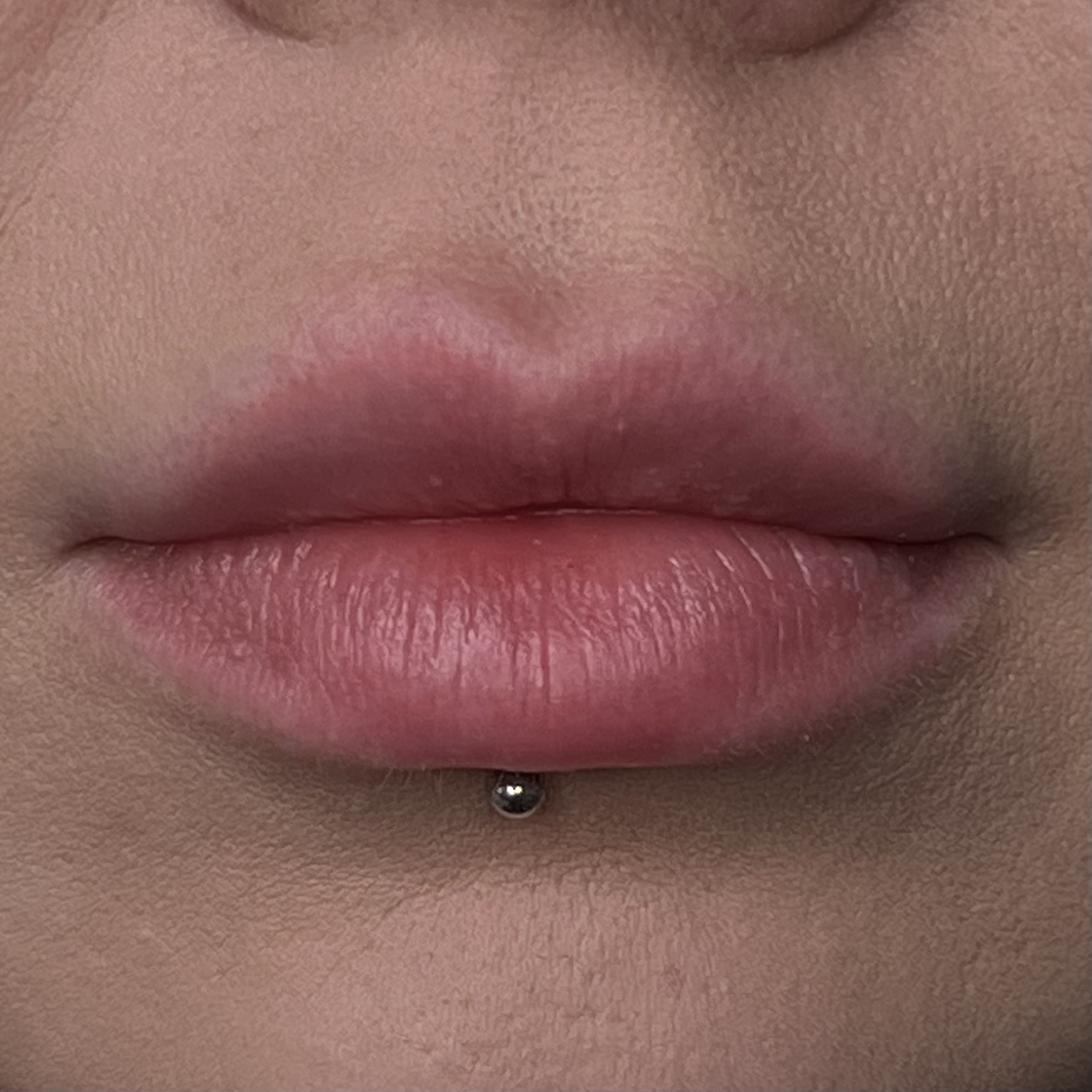lips before