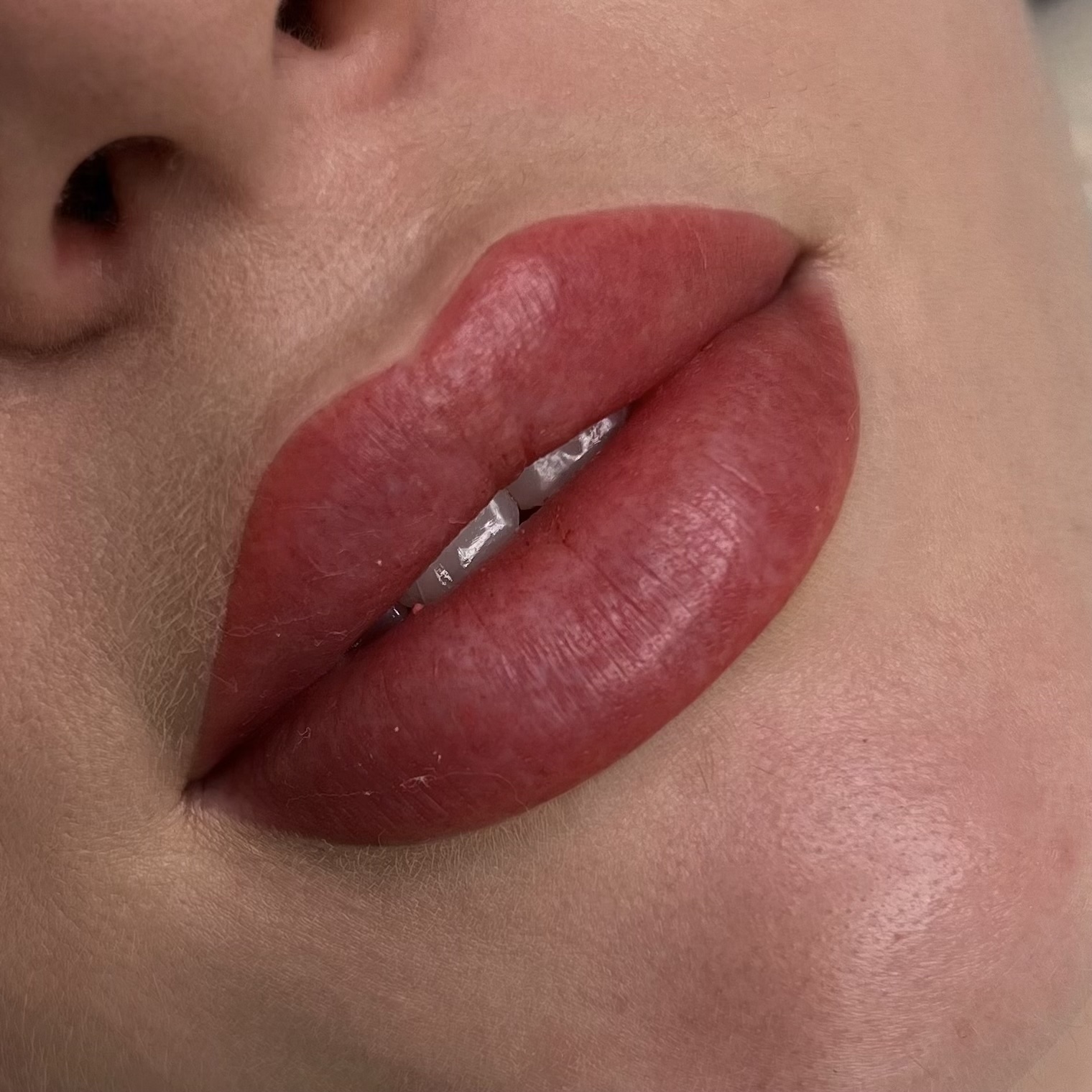masha lips after