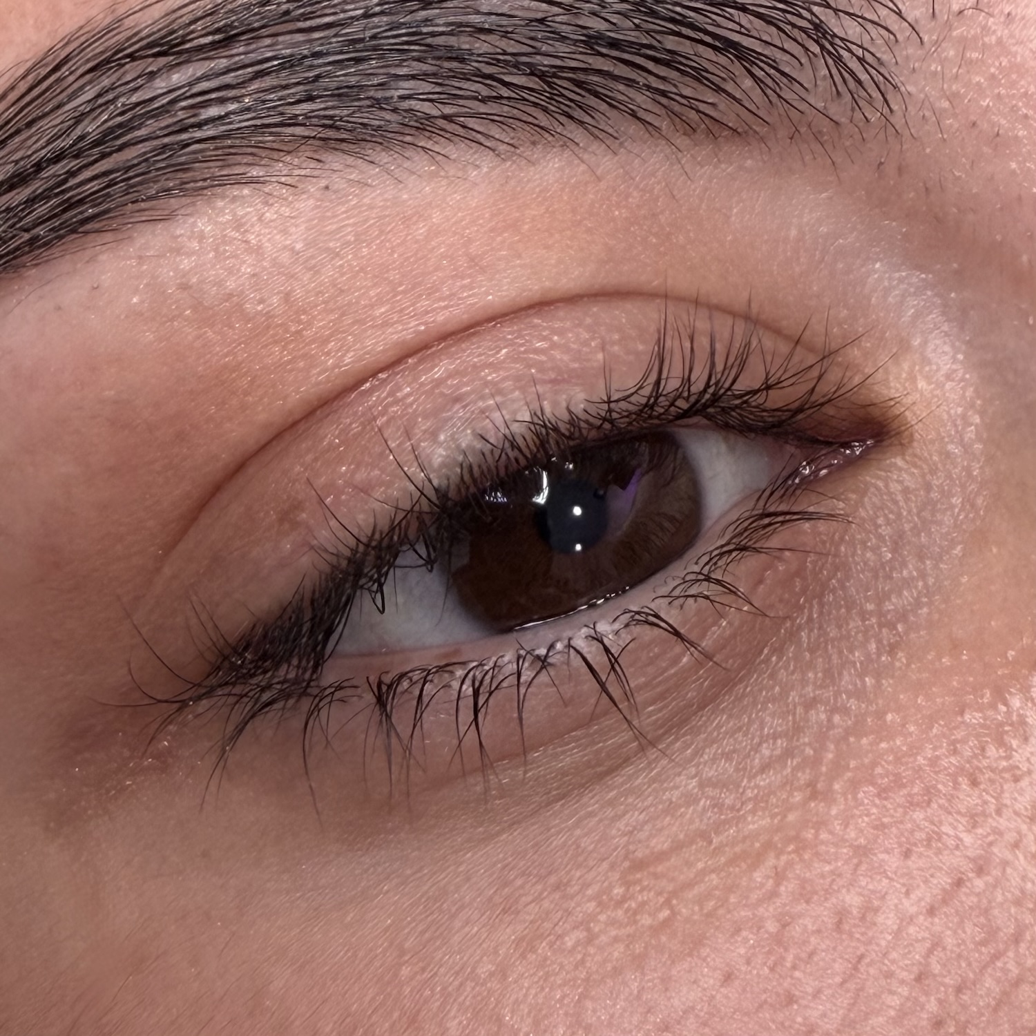 eye 1