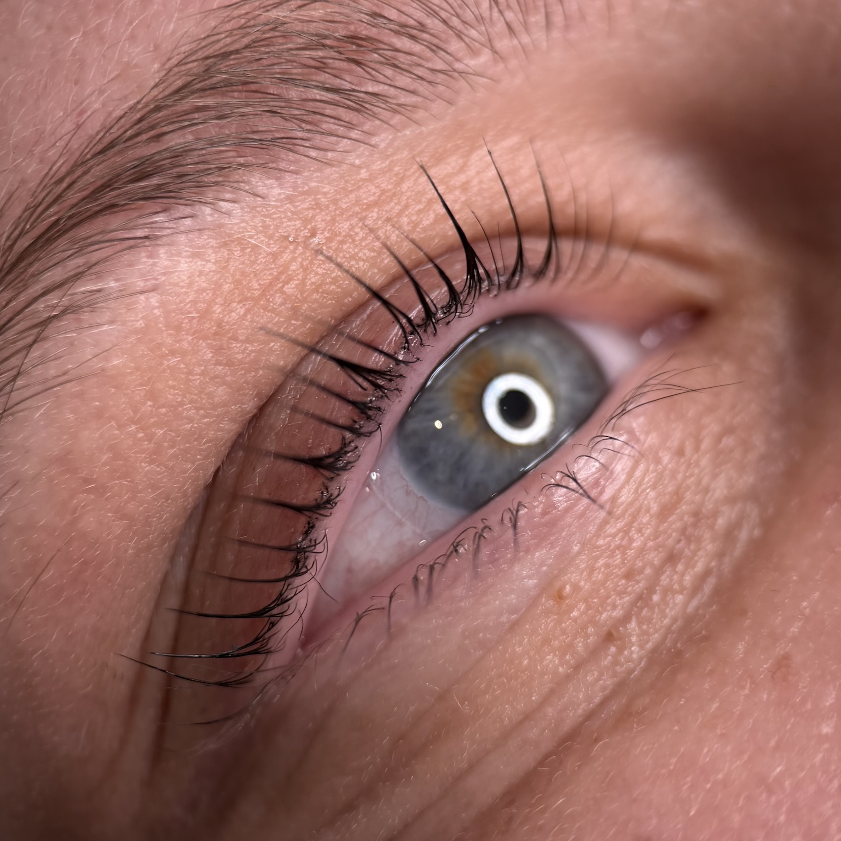 eye after
