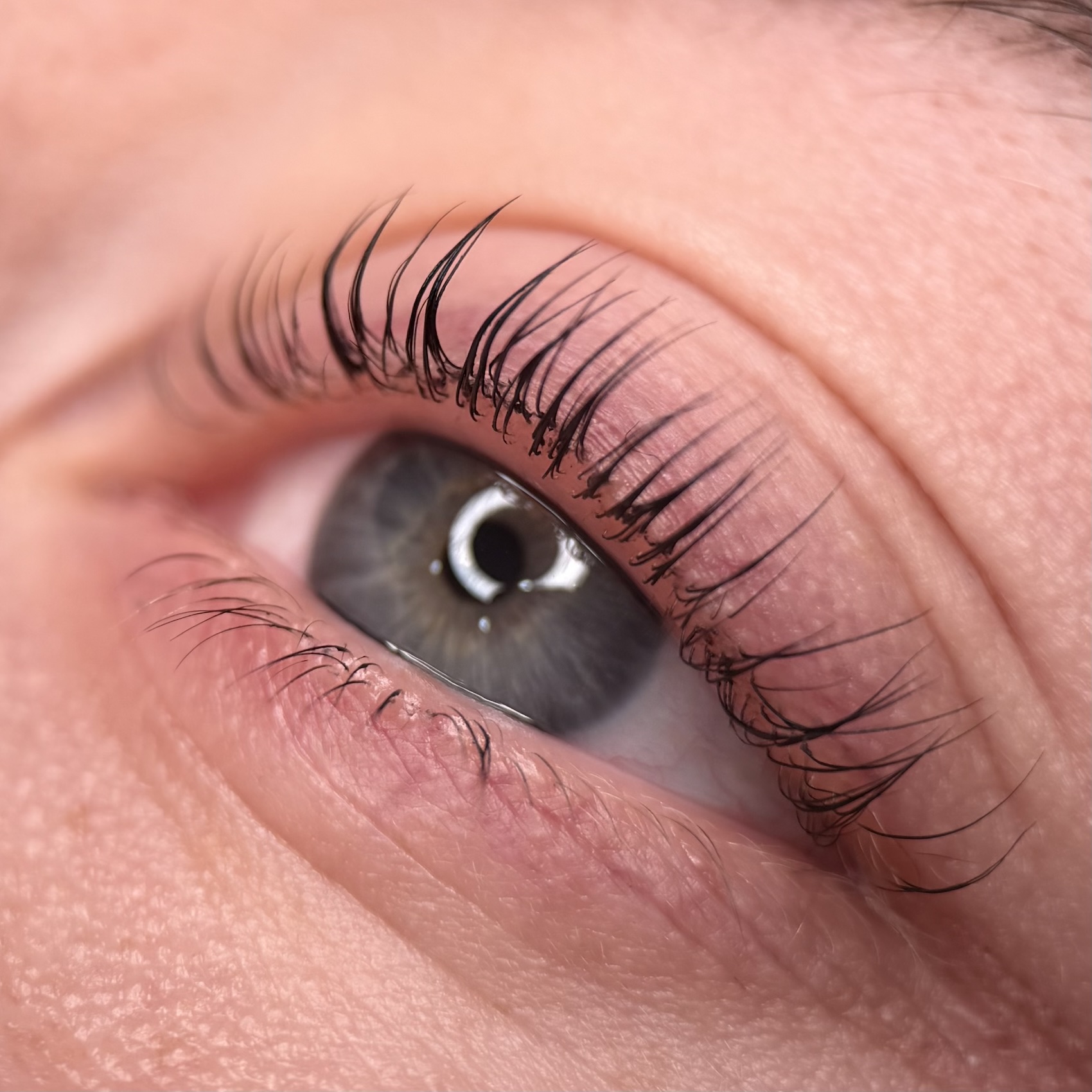 eye after2