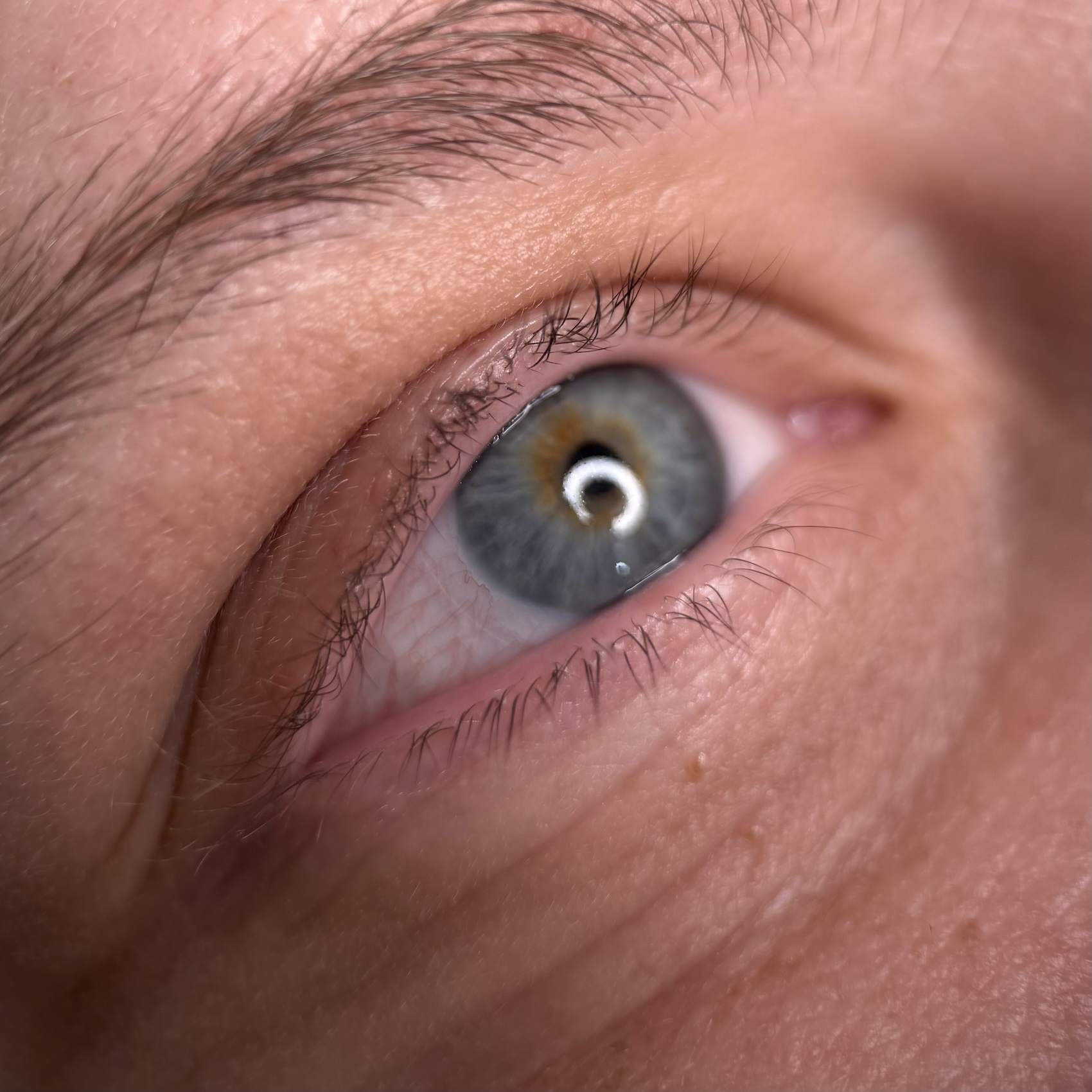 eye before