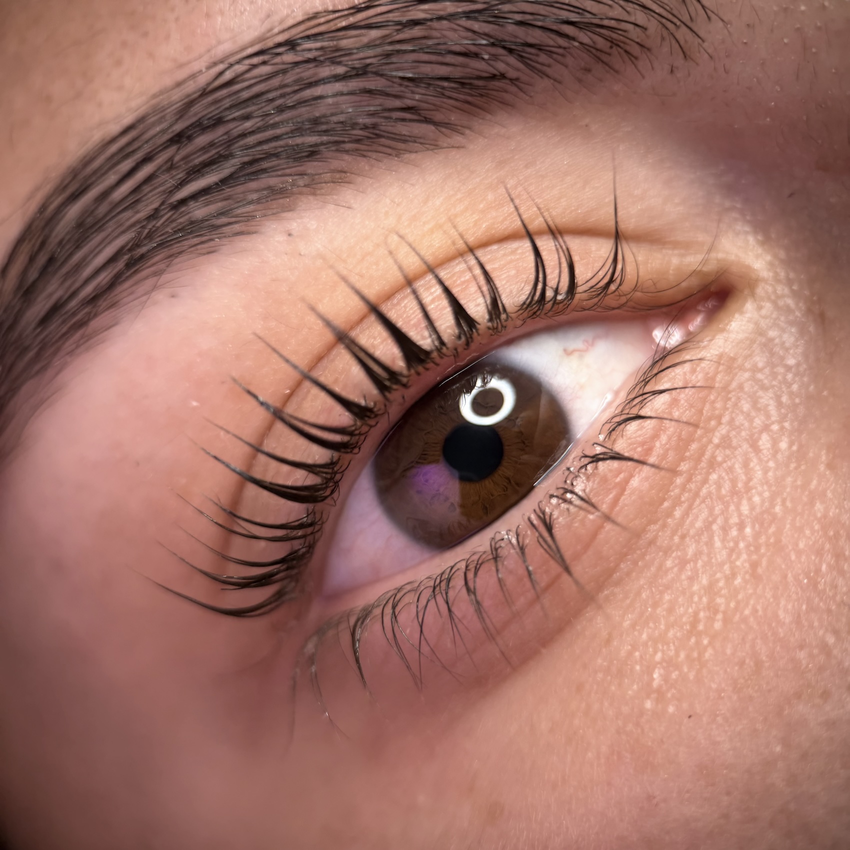 eye2