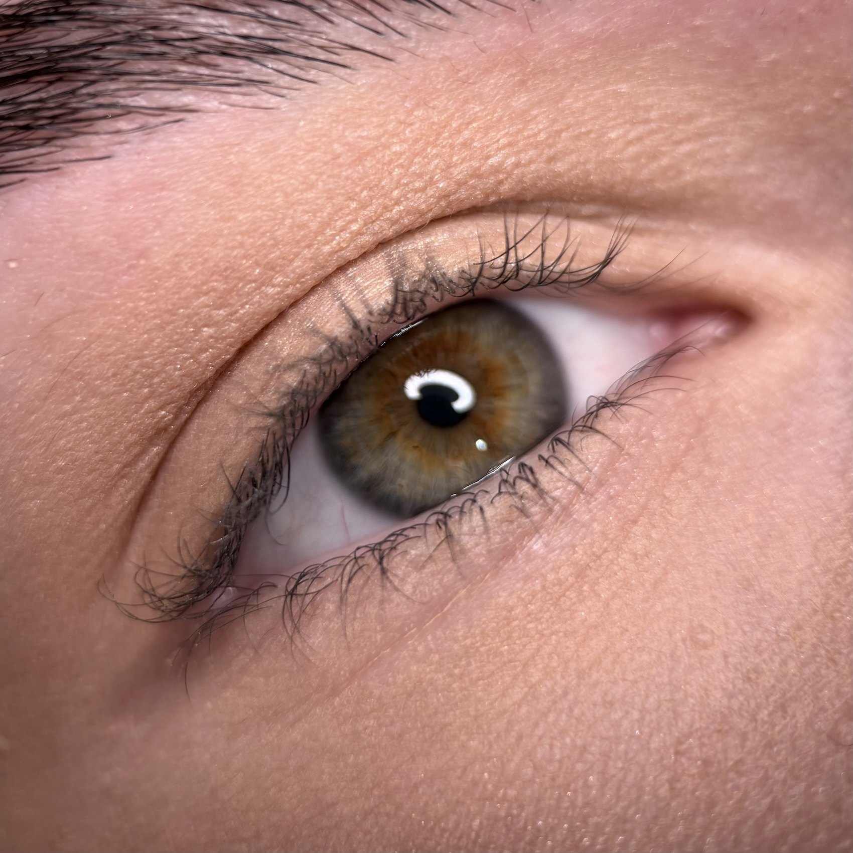 eye5